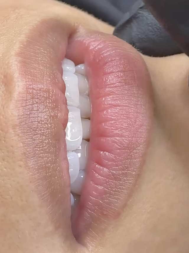 lip-blush-before